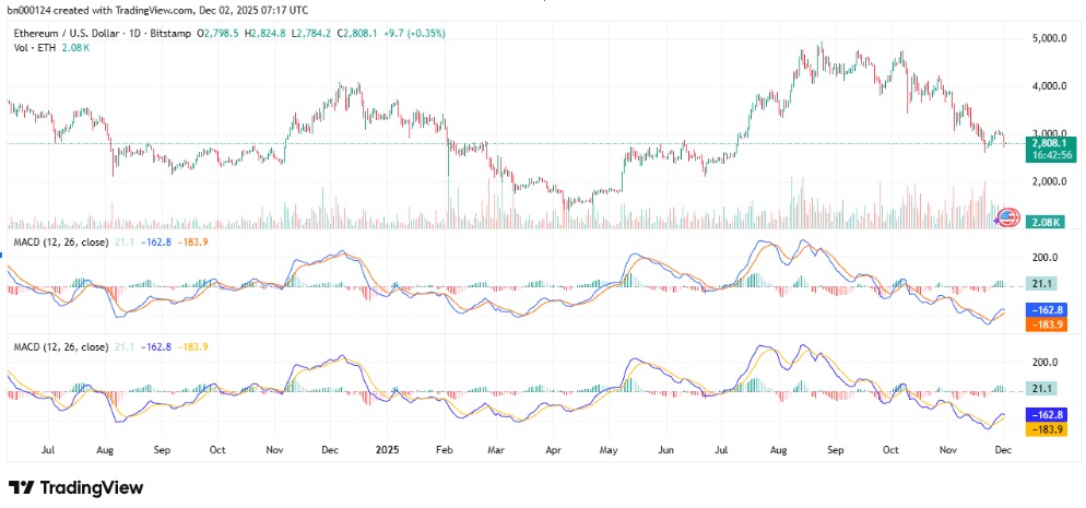 TradingView TradingView